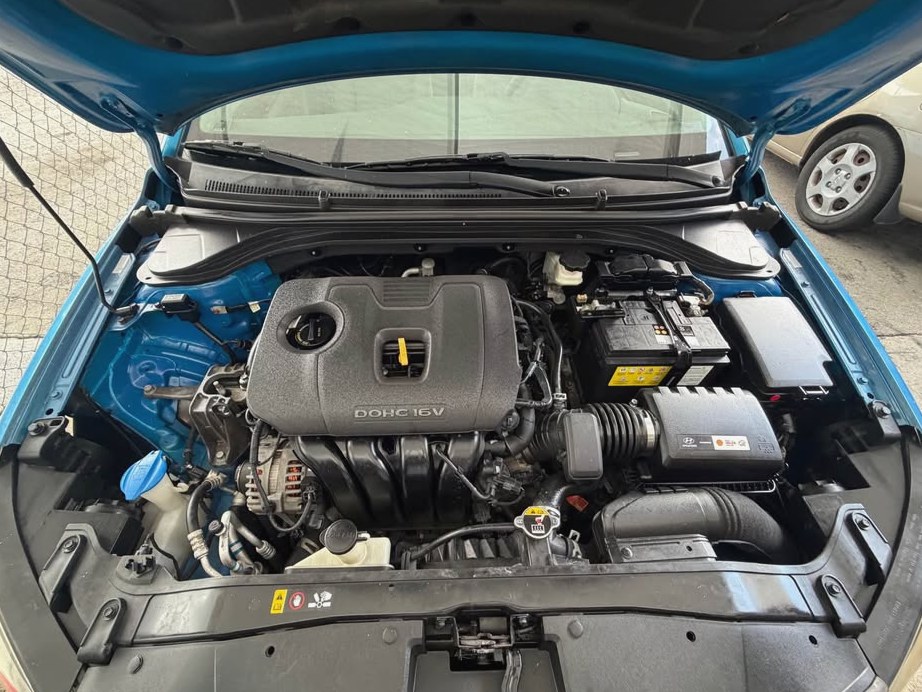 2017 Hyundai Elantra Sport Sedan